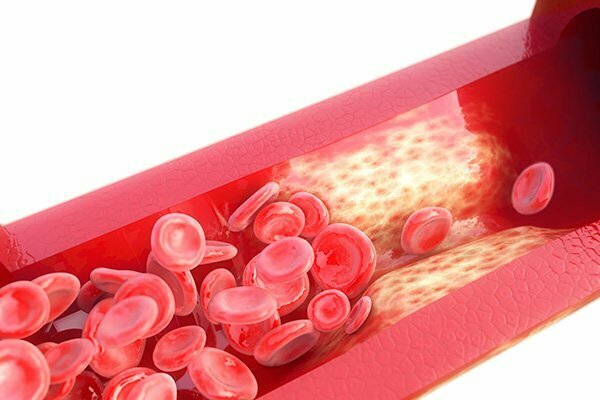 Untreated White-Coat Hypertension Tied to CV Events, Mortality
